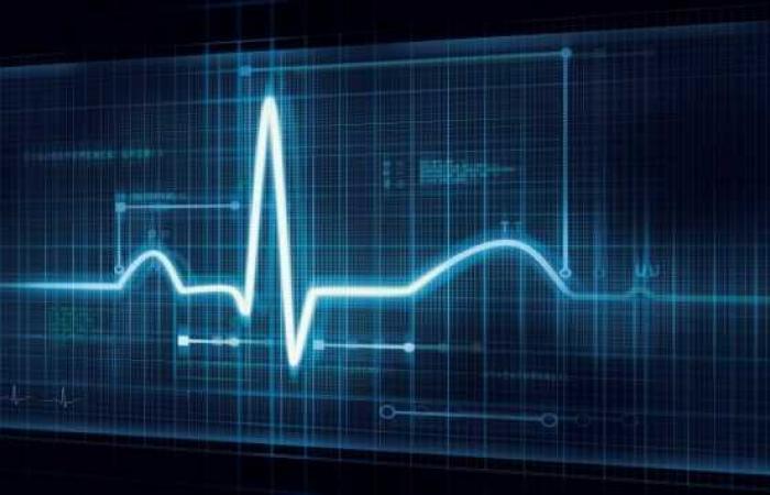 دراسة : الإجهاد قد يسبب عدم انتظام ضربات القلب