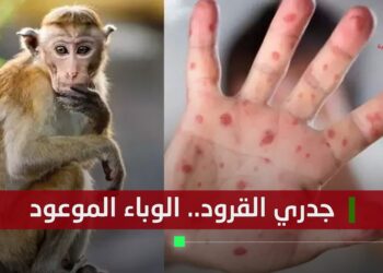 جدري القرود.. الوباء الموعود
