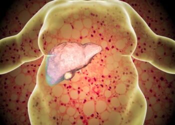 فاكهة غريبة تقلل من دهون الكبد.. ماهي؟