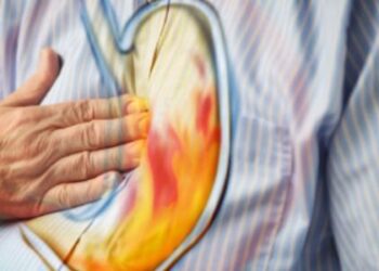 حموضة المعدة المتكررة.. علام تدل؟