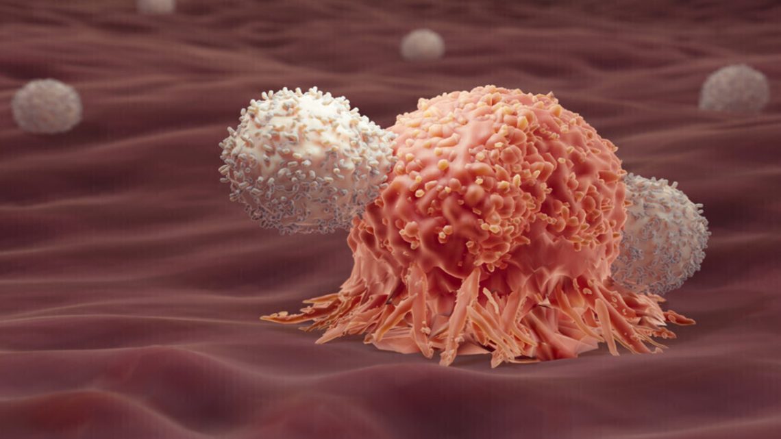 عاجل .. تطوير جهاز للكشف عن السرطان خلال 60 دقيقة