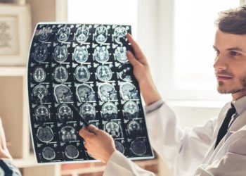 العلماء يخترعون طريقة لاستعادة الدماغ بعد السكتة الدماغية