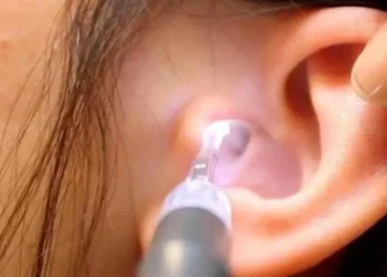 حاسة السمع أقوى عند النساء أم الرجال؟.. هذه الدراسة توضح