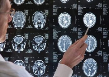 علماء يكتشفون طريقة جديدة لتحسين علاج أورام الدماغ