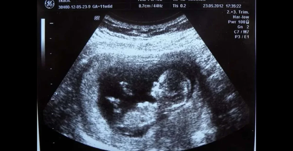 دراسة جديدة تحذّر من الحمل بعد 45 عاماً