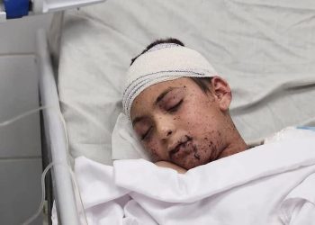 إيطاليا تستقبل 80 فلسطينيا للعلاج بينهم آدم الذي فقد 9 من أشقائه