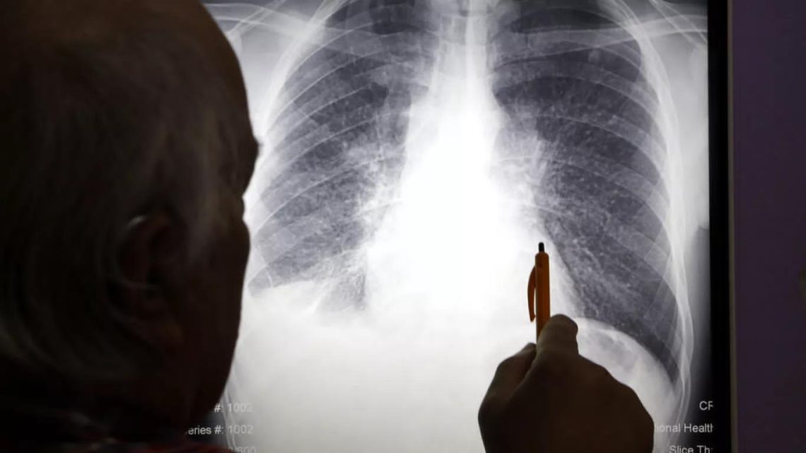 تلوث الهواء يسبب طفرات جينية مرتبطة بسرطان الرئة.. كيف ذلك؟