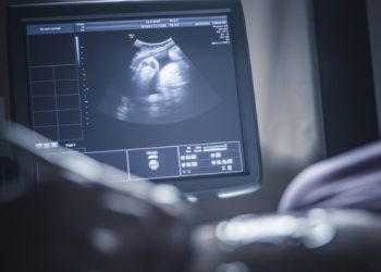دراسة: تلوث الهواء يبطئ نمو دماغ الأطفال حديثي الولادة
