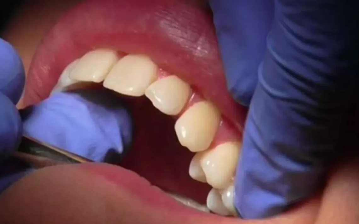 كيف  تحميك صحة أسنانك من الموت المبكر؟