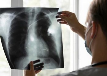 تقنية جديدة ترصد الالتهاب الرئوي عبر تحليل النفس بدقة عالية